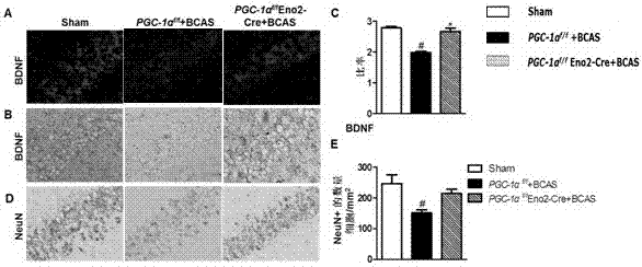 Application of PGC-1Alpha (peroxisome proliferator-activated receptor-gamma coactivator-1alpha) in preparation of medicines for treating vascular dementia