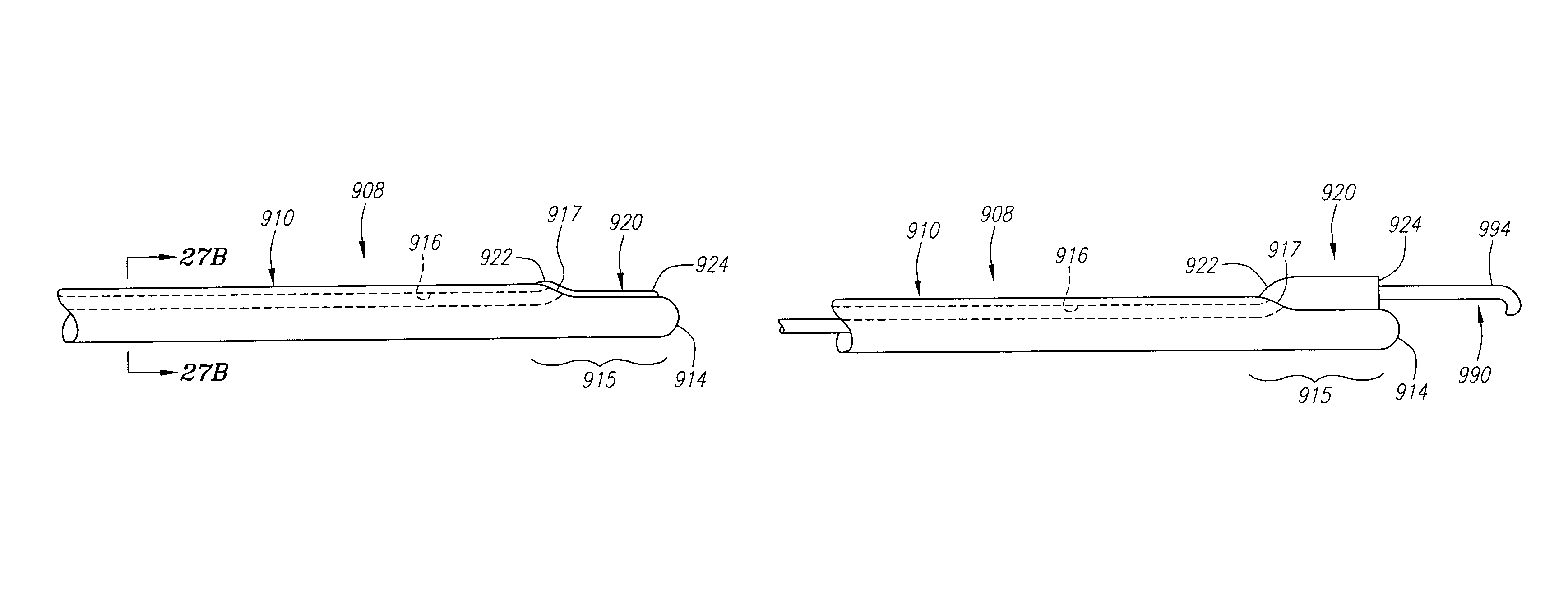 Expandable sheath for delivering instruments and agents into a body lumen and methods for use