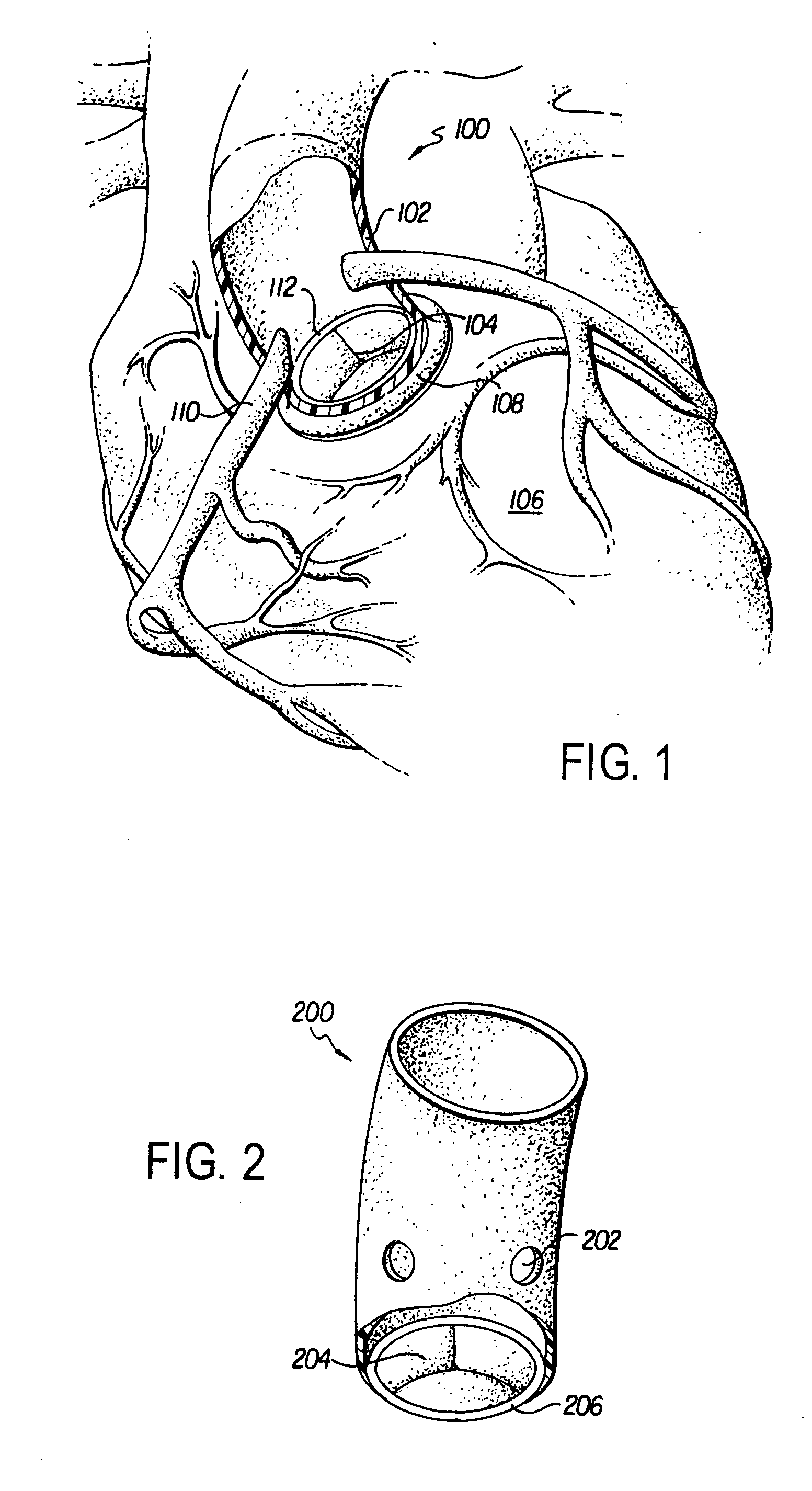 Heart model for training or demonstrating heart valve replacement or repair