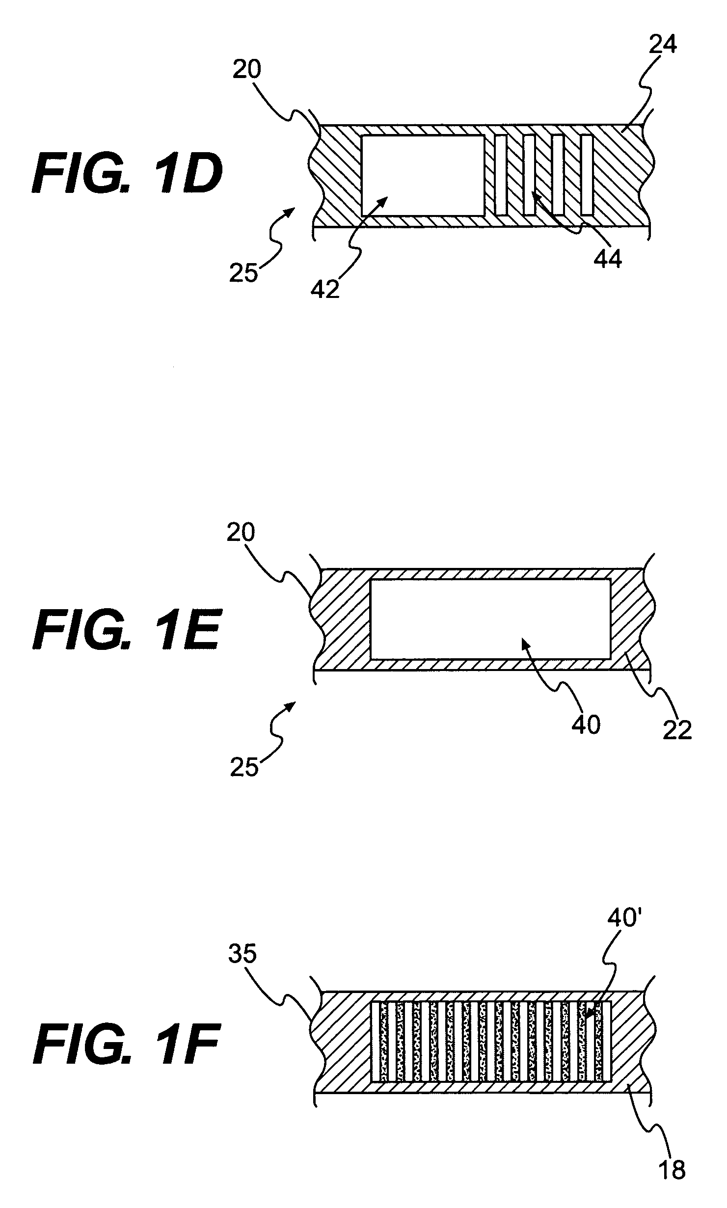 Textile-based electrode