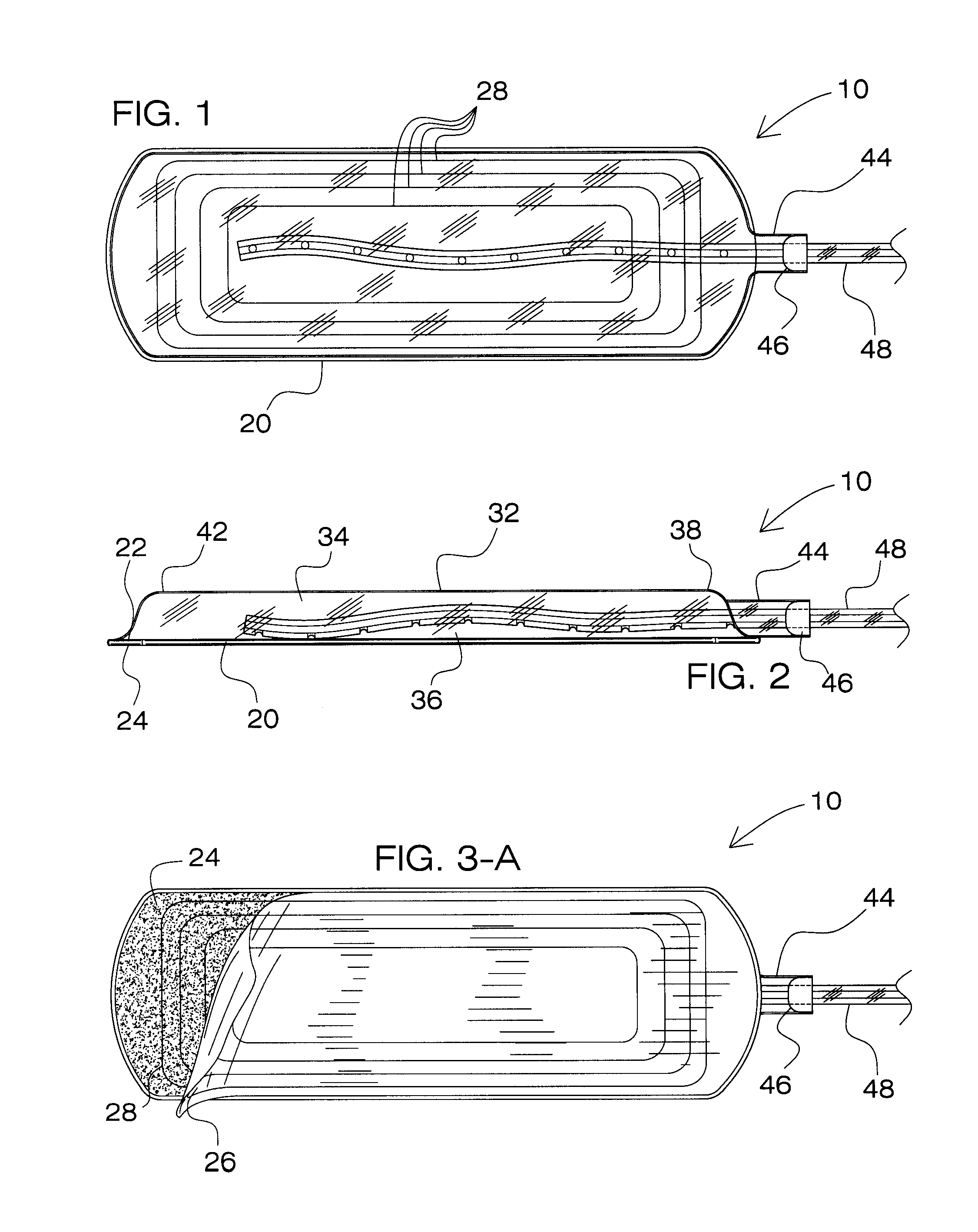 System and Method for Draining Bodily Fluids from a Treatment Site