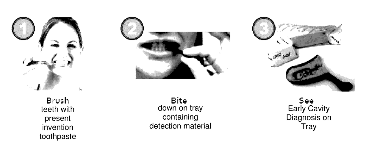 Methodology of dental caries detection