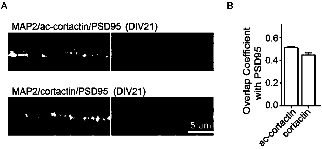 Cortex actin mutant 8KQ and application