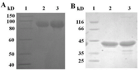 Recombinant human fibroblast growth factor 21 fusion protein and application thereof in preparation of medicine for treating metabolic diseases