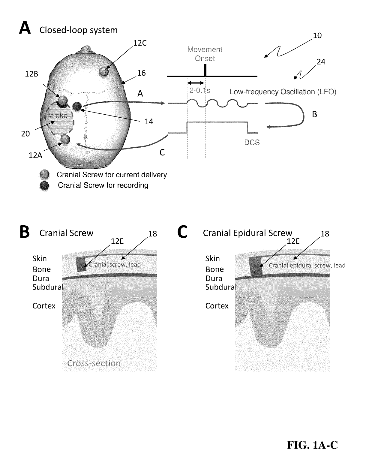 Systems Methods and Devices for Closed Loop Stimulation To Enhance Stroke Recovery