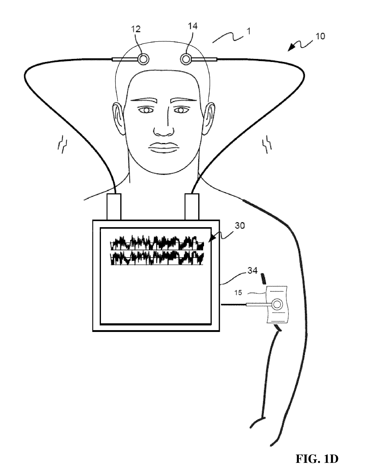 Systems Methods and Devices for Closed Loop Stimulation To Enhance Stroke Recovery