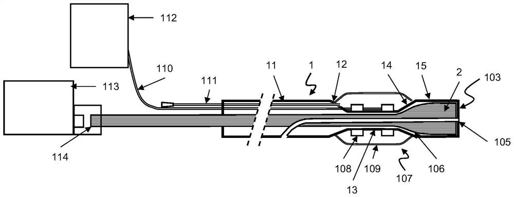 A catheter integrating laser ablation and shock wave angioplasty