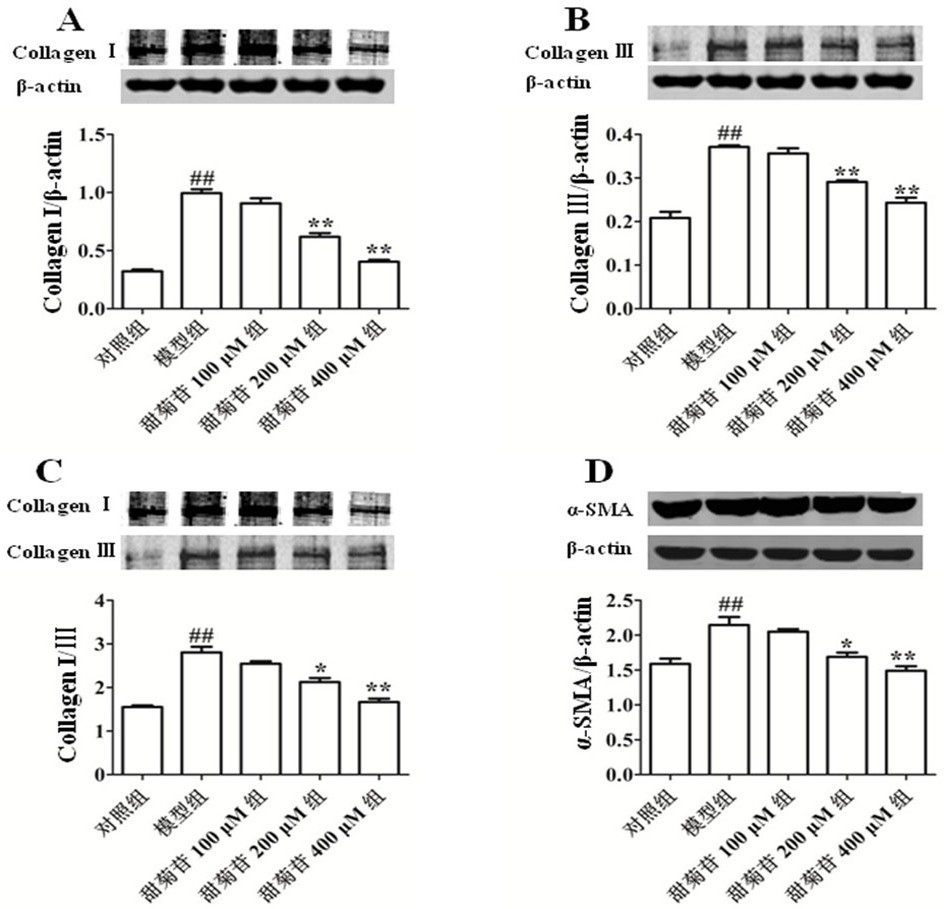 Application of stevioside in preparation of health food and medicine for preventing or treating myocardial fibrosis