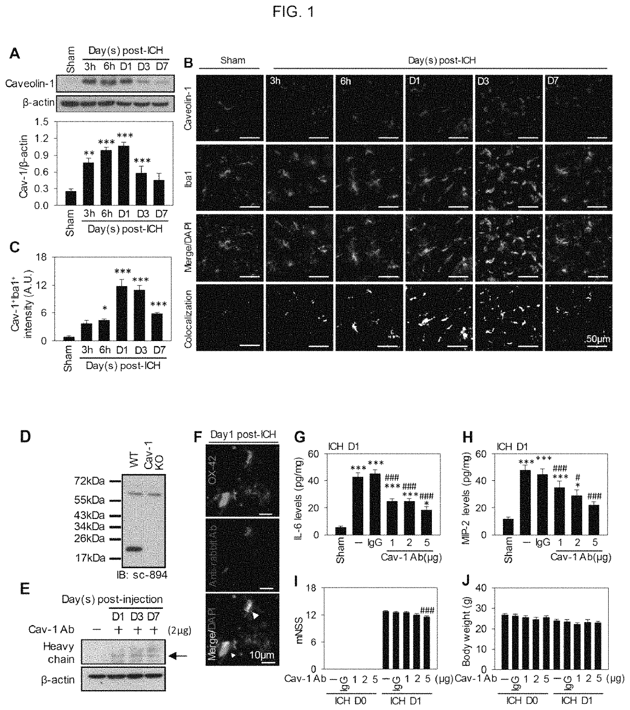 Caveolin-1 antibody for use in treating brain inflammation and injury and improving functional recovery