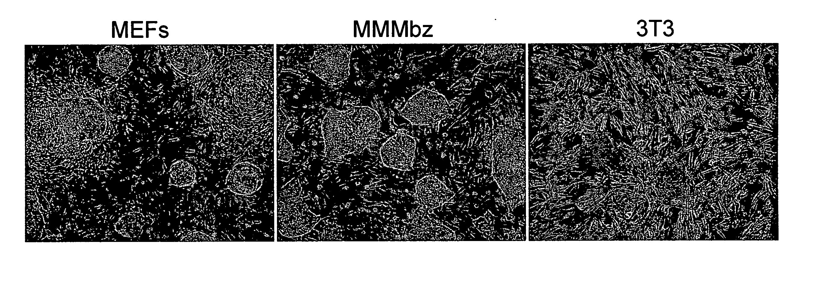 Immortalized fibroblasts