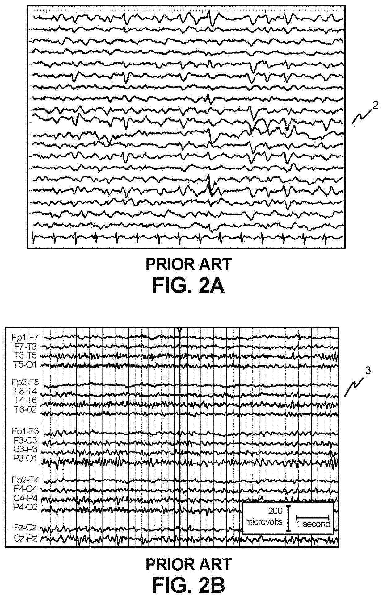 Apparatus, systems and methods for predicting, screening and monitoring of mortality and other conditions   uirf 19054