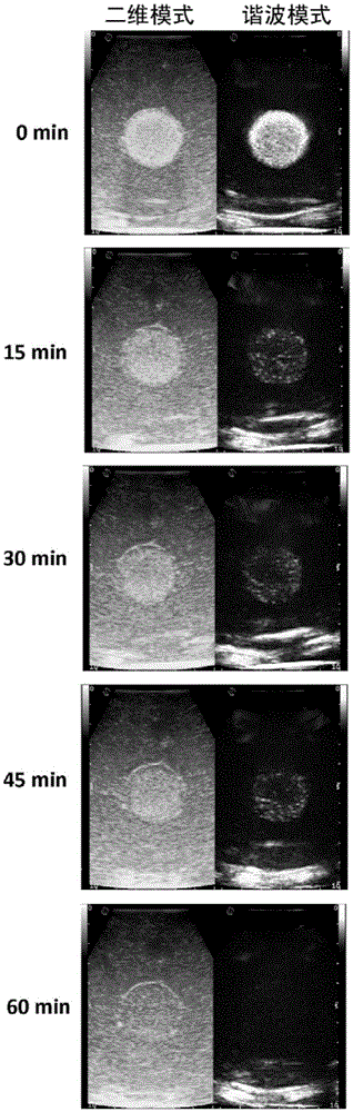 Profile model for simulating performance of tumor contrast-enhanced ultrasonography and applied in tumor diagnosis and treatment study