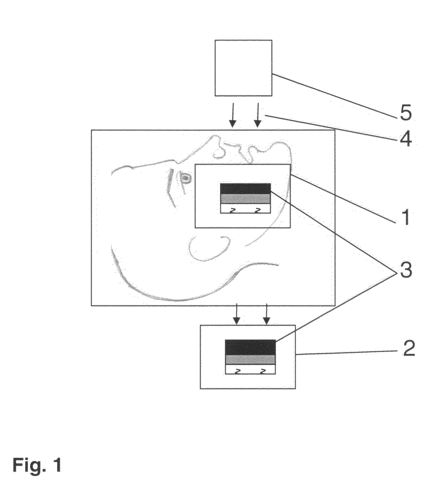 Dental fluoroscopic imaging system