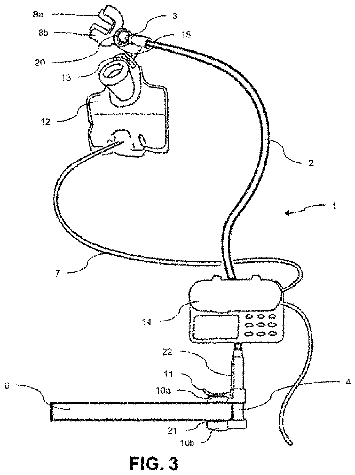 Device and Method Useful in Mobile Administering of Feed Products to Patients