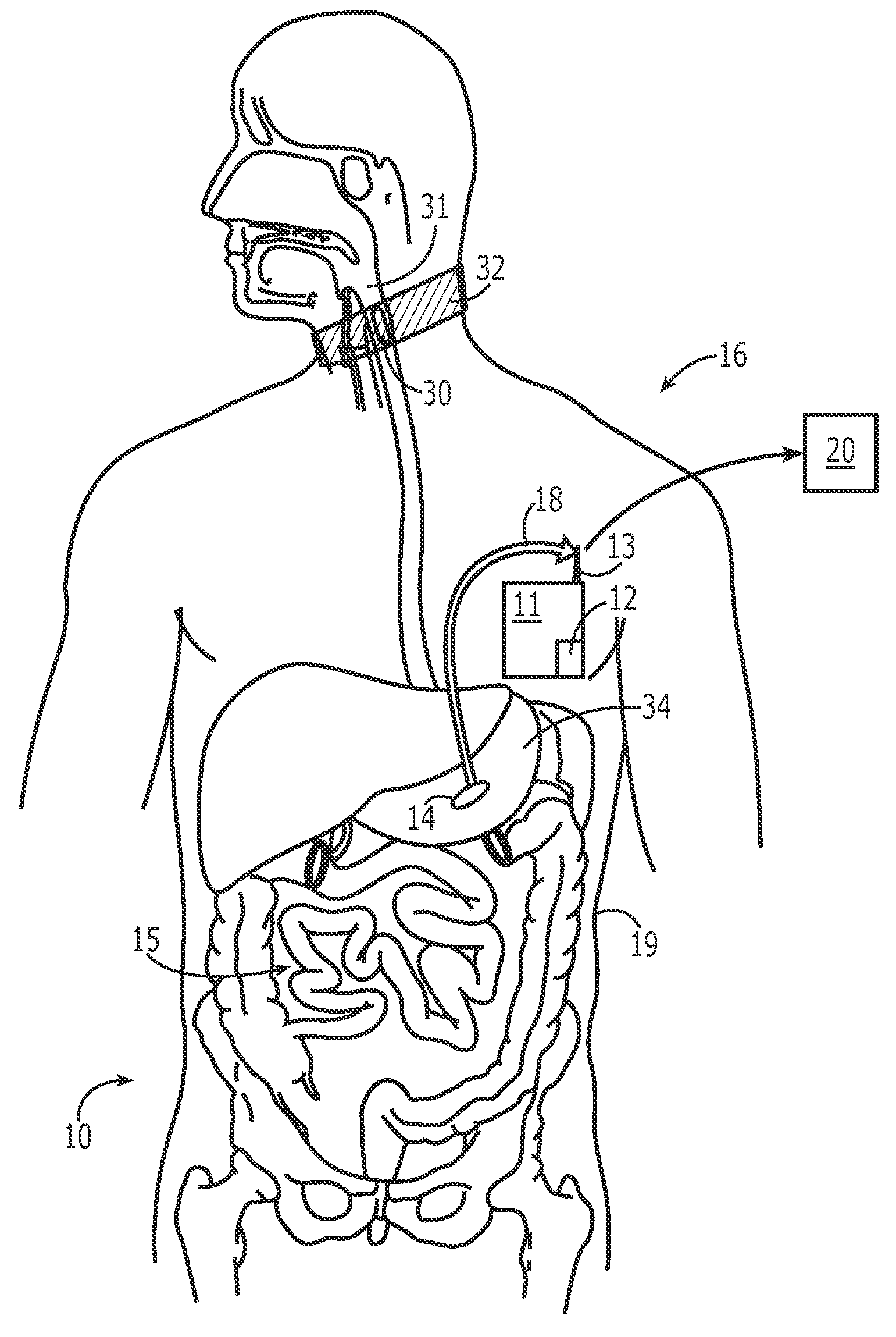 Medication compliance system and associated methods