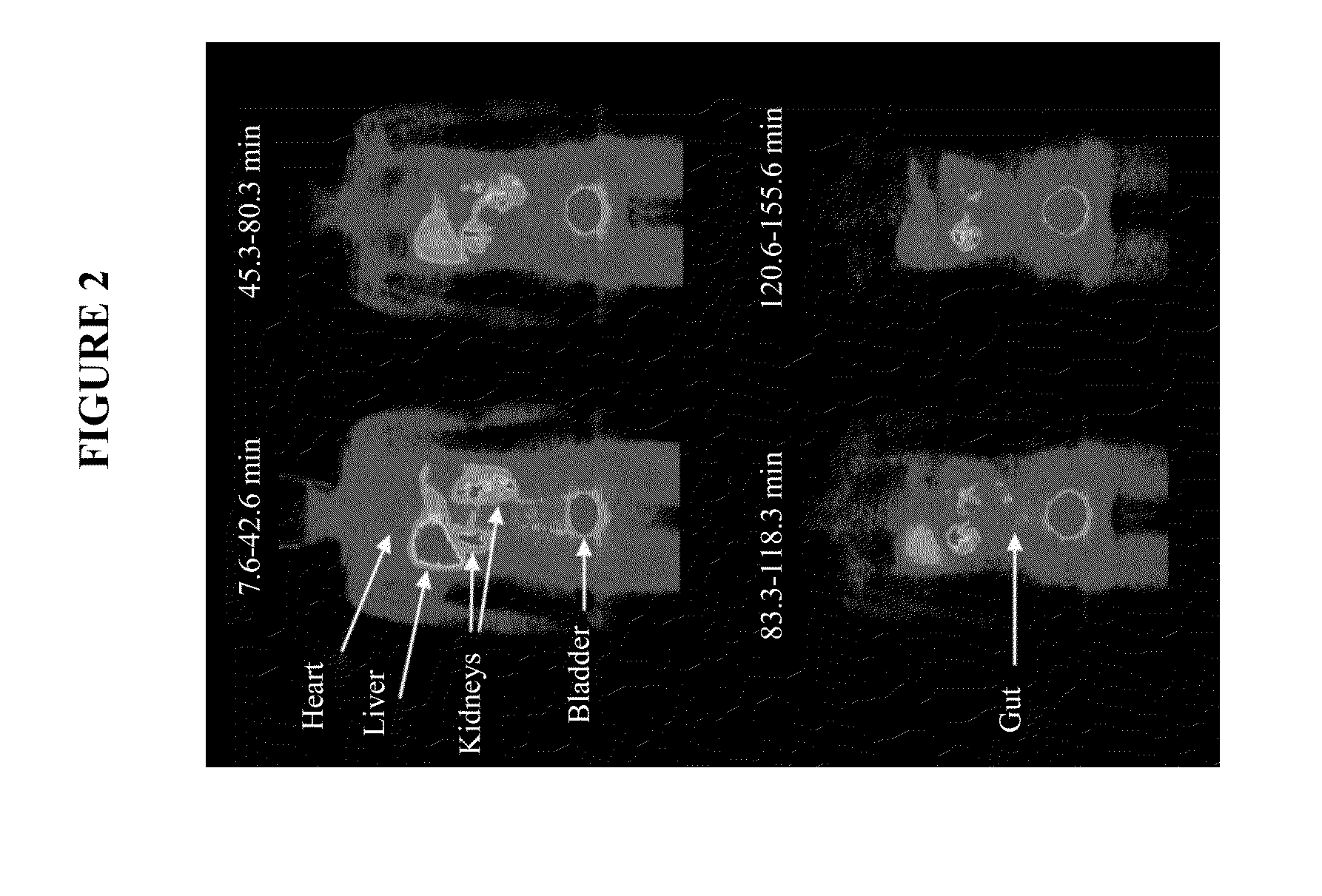 Thymidine kinase diagnostic assay for gene therapy applications