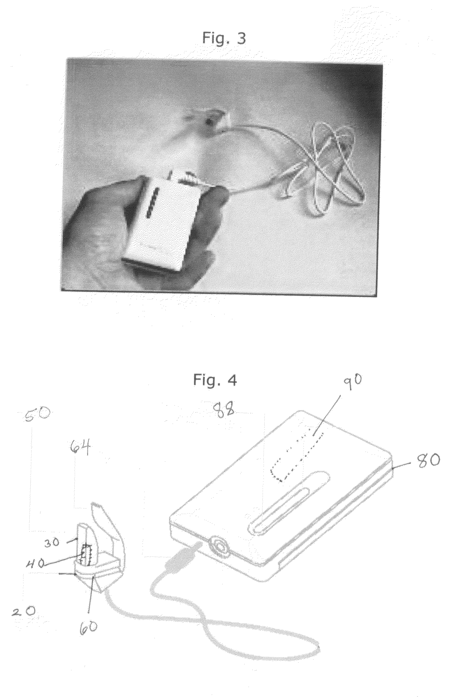 Method and portable system for non-invasive, In-vivo blood irradiation light therapy
