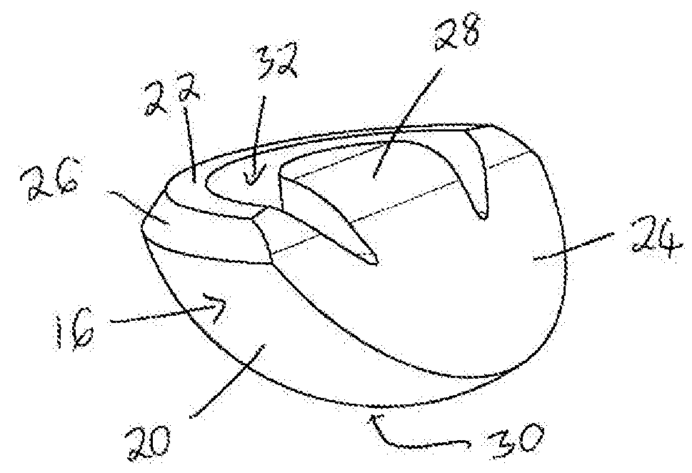 Prosthetic component with crosslinked polymer wear zone and edge protection