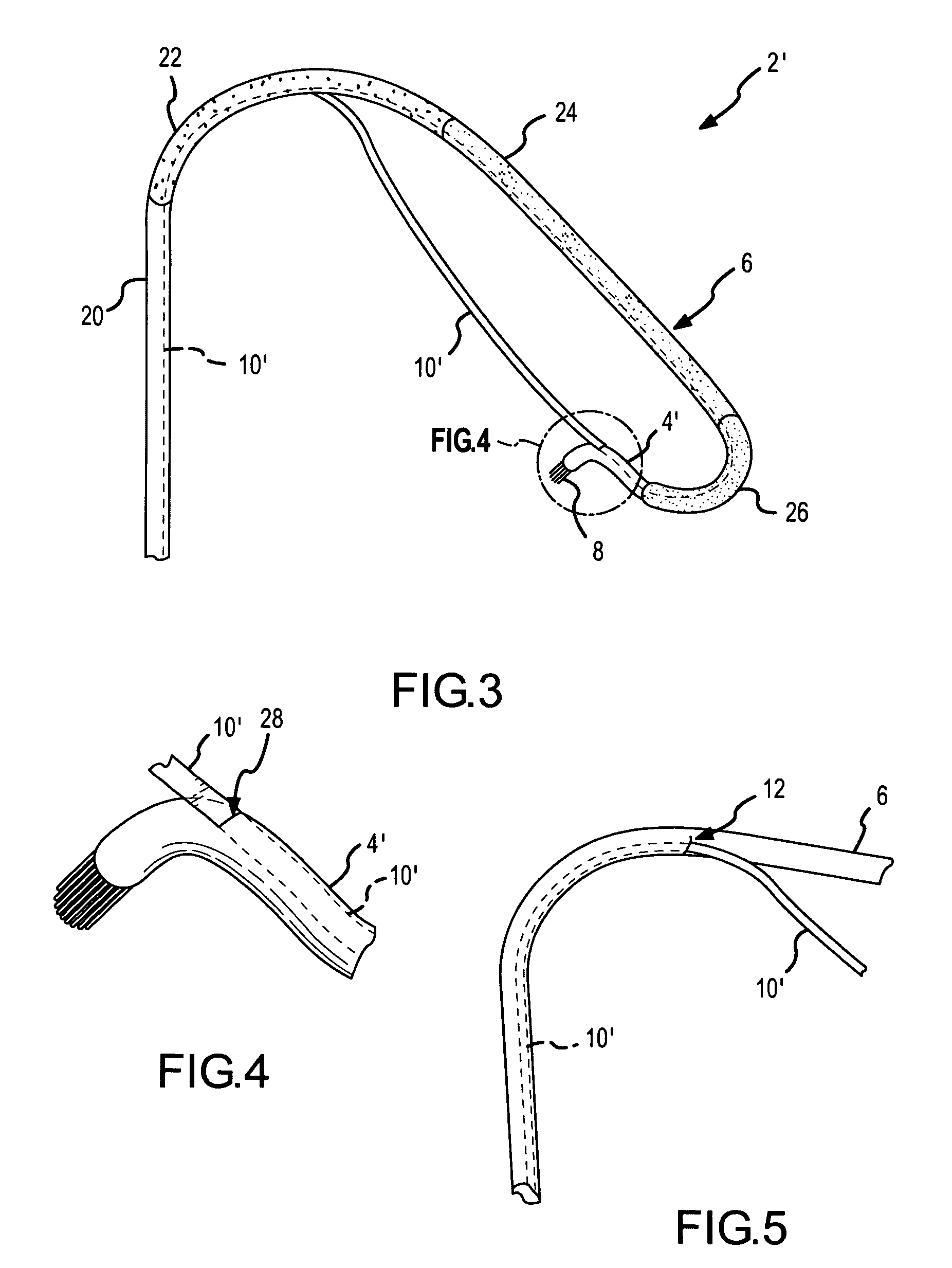 Catheter electrode and rail system for cardiac ablation