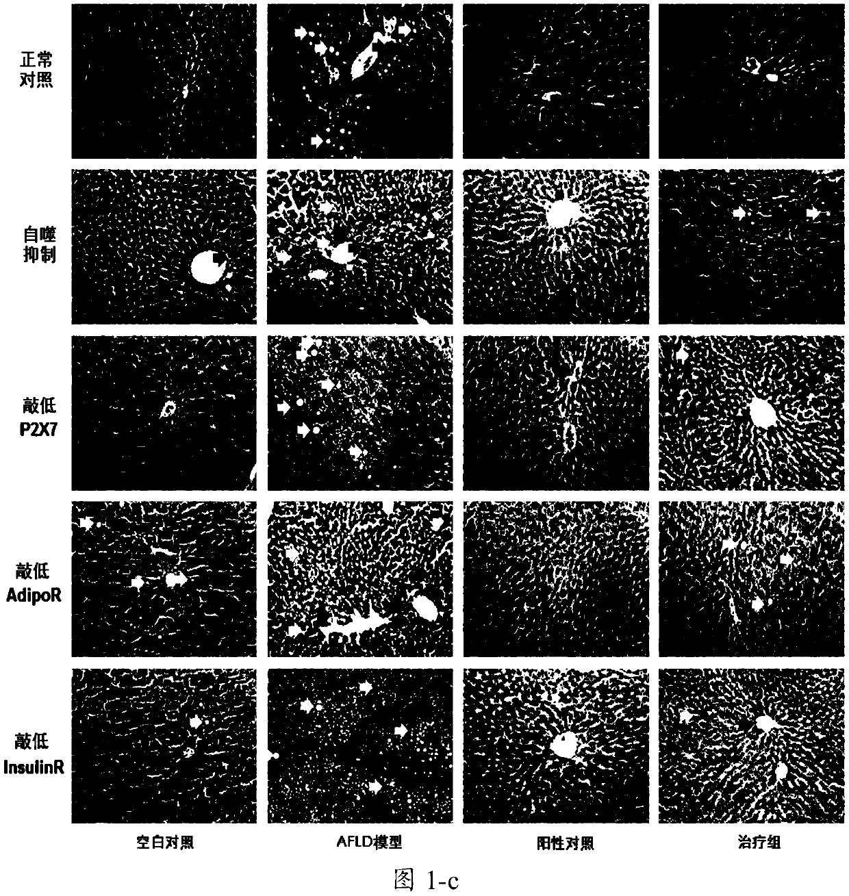 Mechanism of Lycium barbarum anti-alcoholic liver injury and application of hepatoprotective products