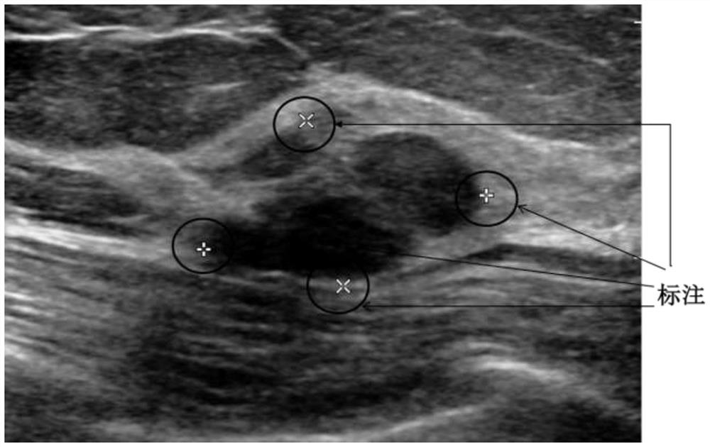 A Real-time Detection and Decision Fusion Method for Continuously Scanning Breast Ultrasound Images