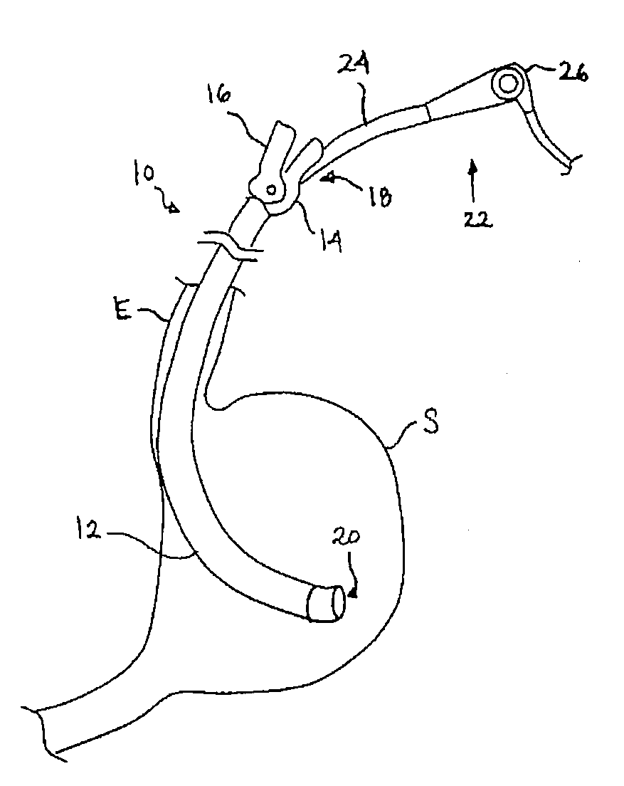 Instrument assisted abdominal access
