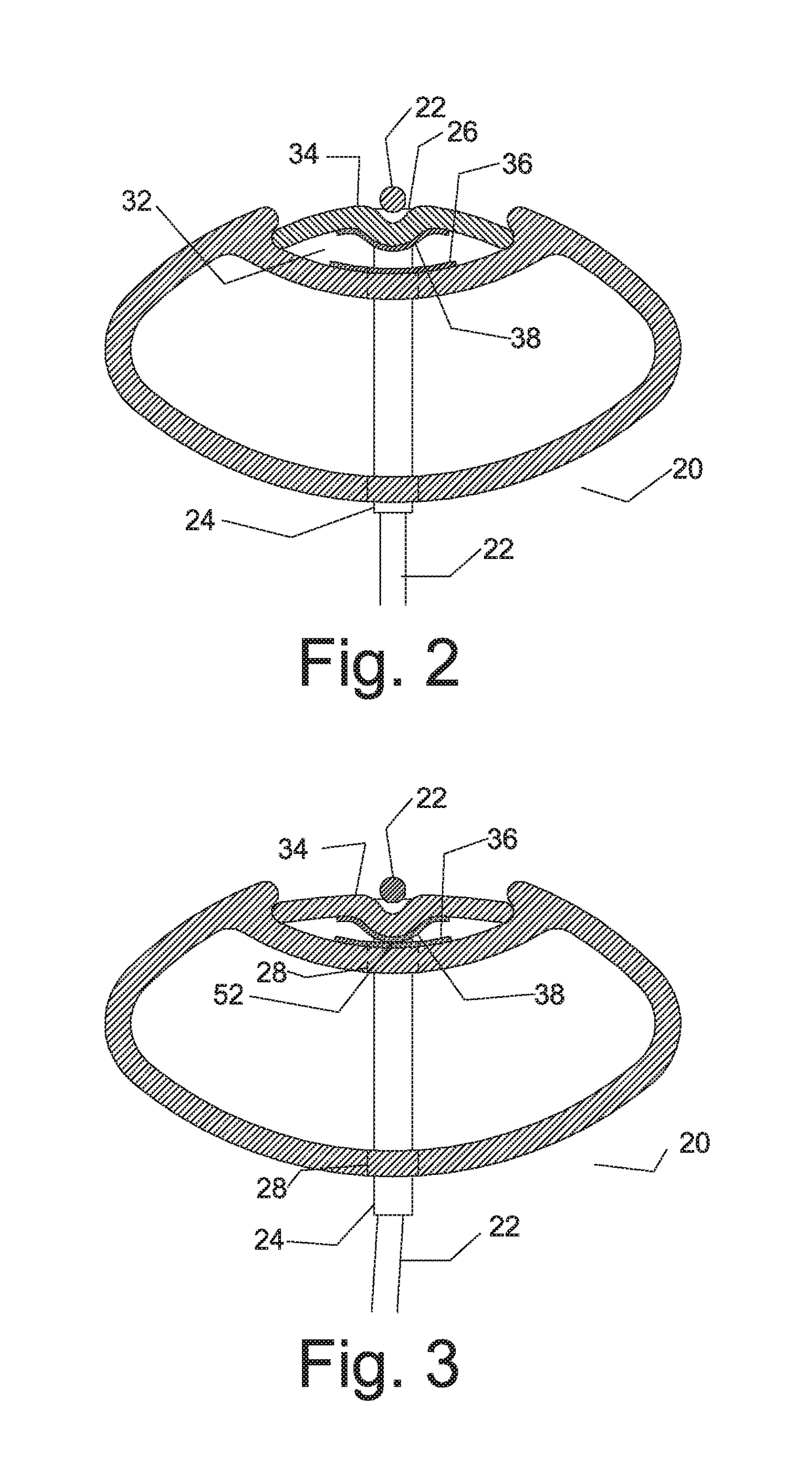 System and method for a game racquet including a grommet actuator