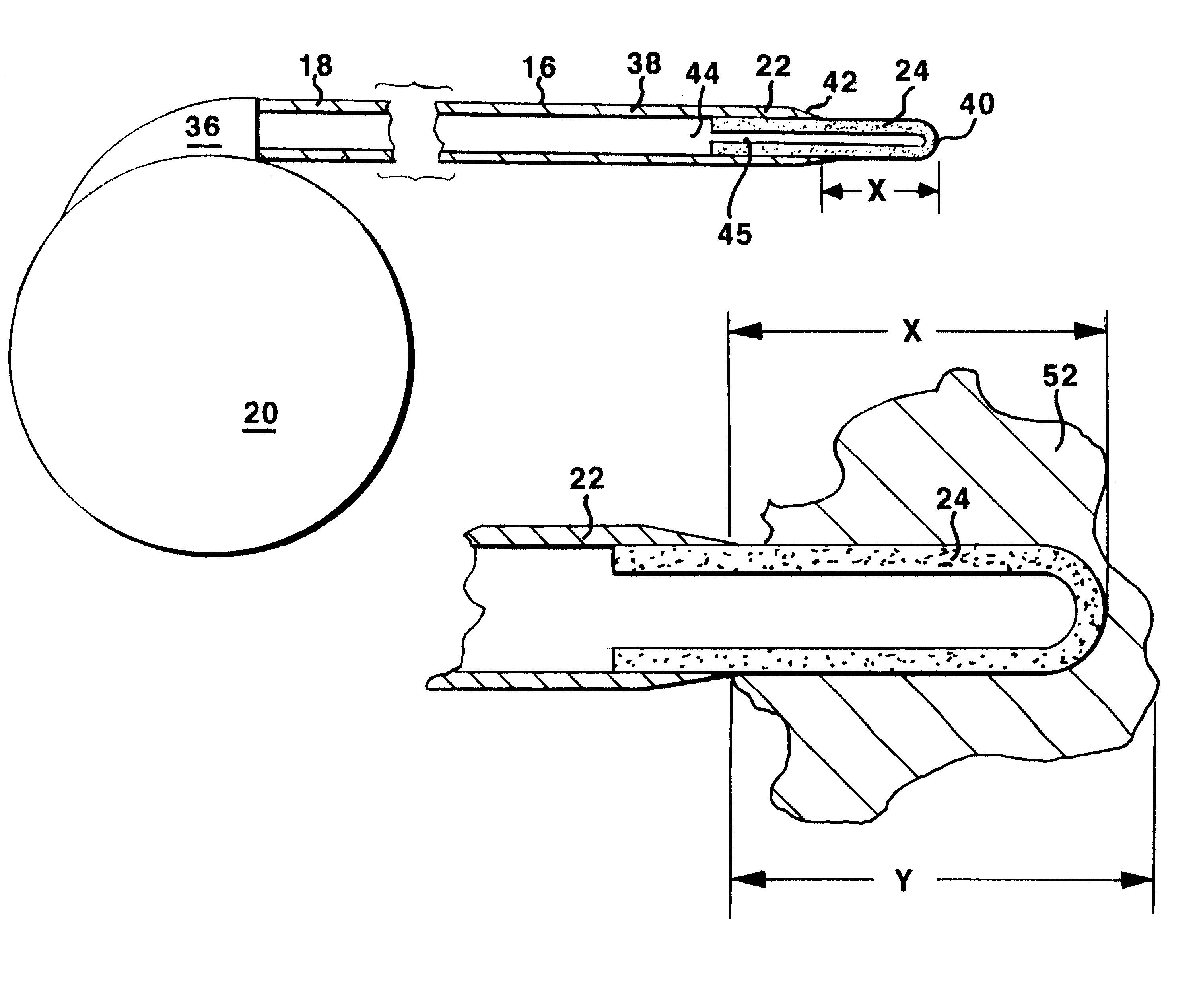 Method for manufacturing a catheter