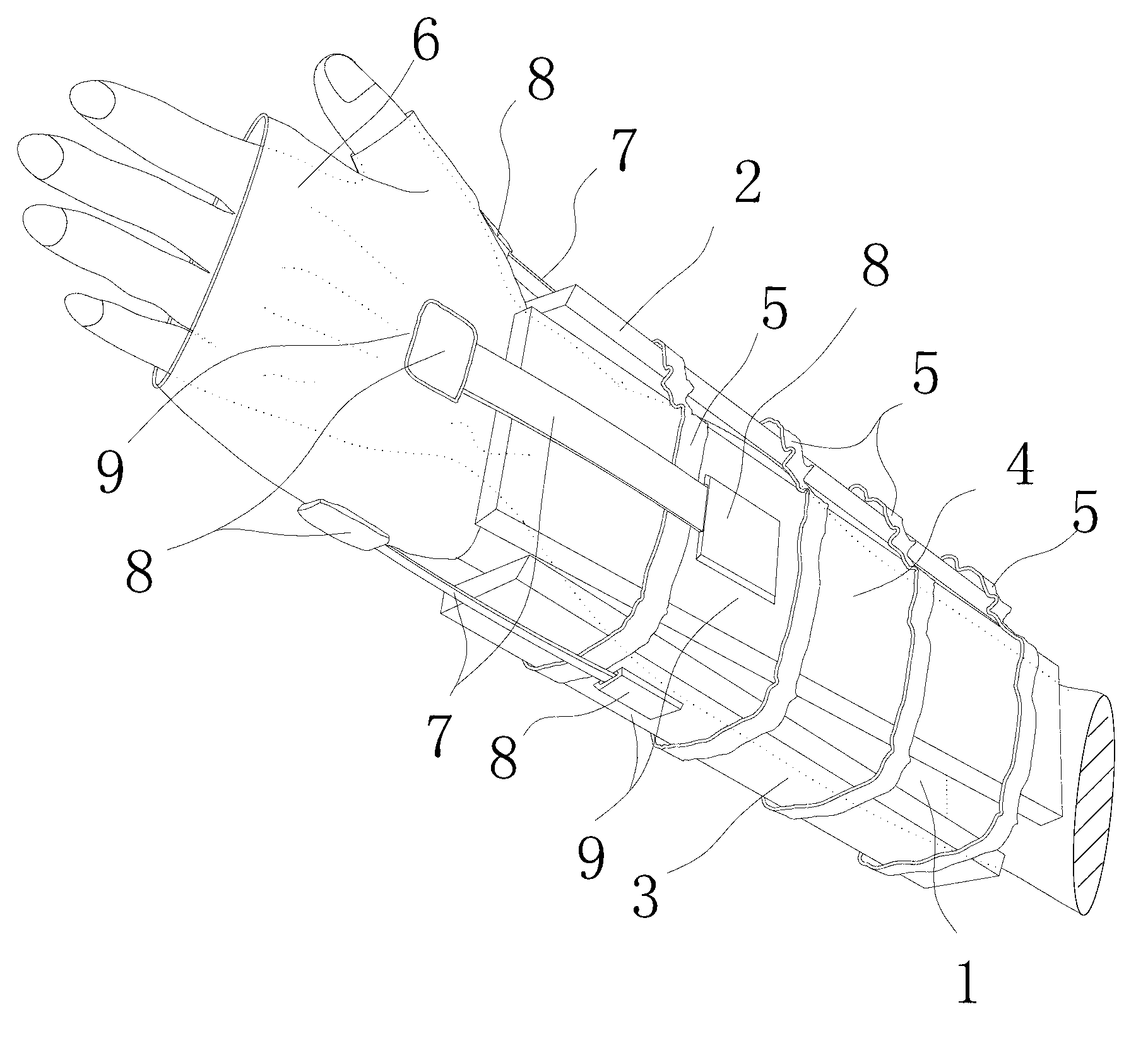 External fixation treatment device for distal radius fracture