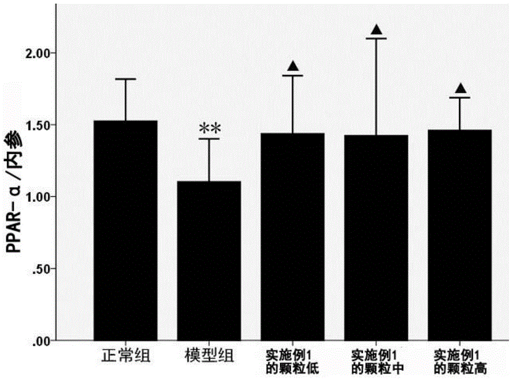 Traditional Chinese medicine composition and preparation thereof