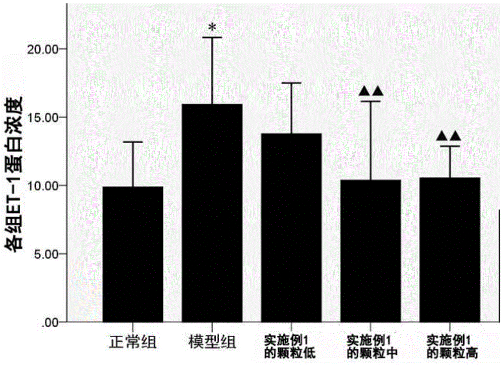 Traditional Chinese medicine composition and preparation thereof