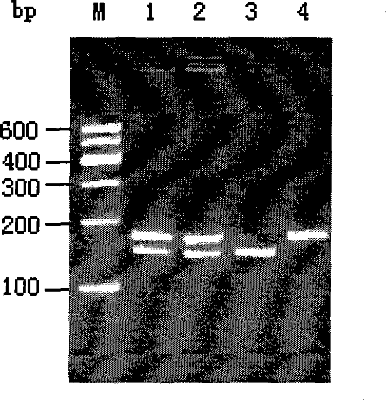 Method for detecting the polymorphism of ADH2 genes