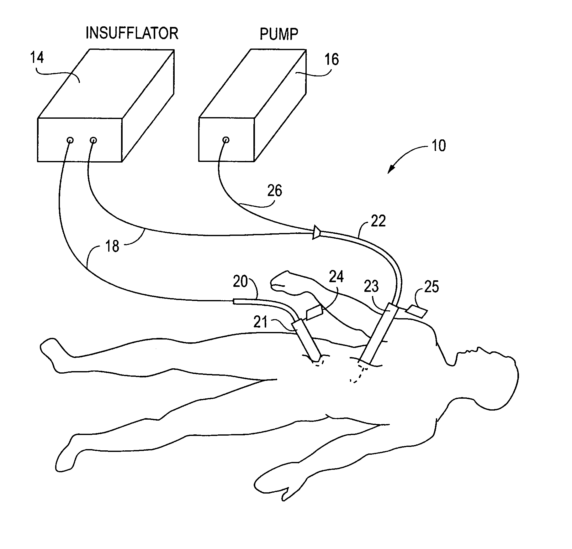 System and method for delivering a substance to a body cavity
