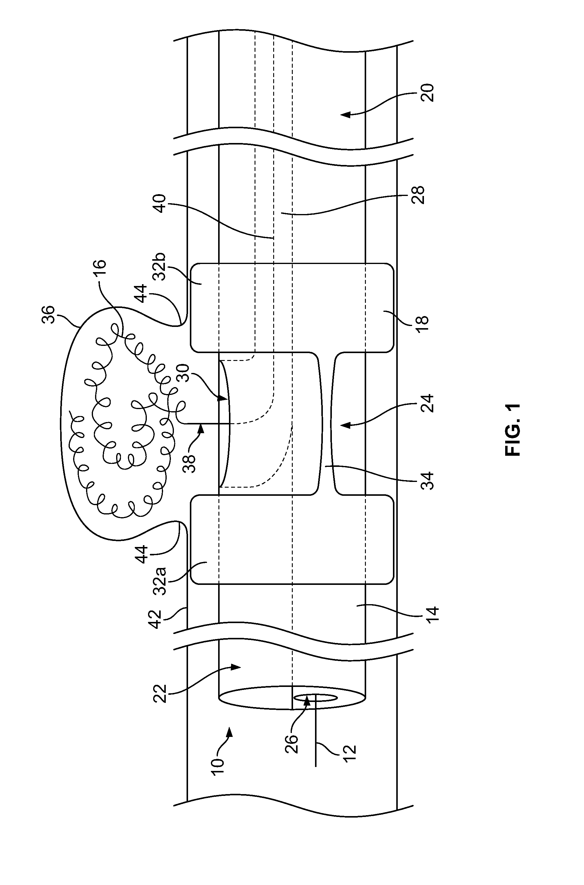 Embolic coil delivery system and method of using same