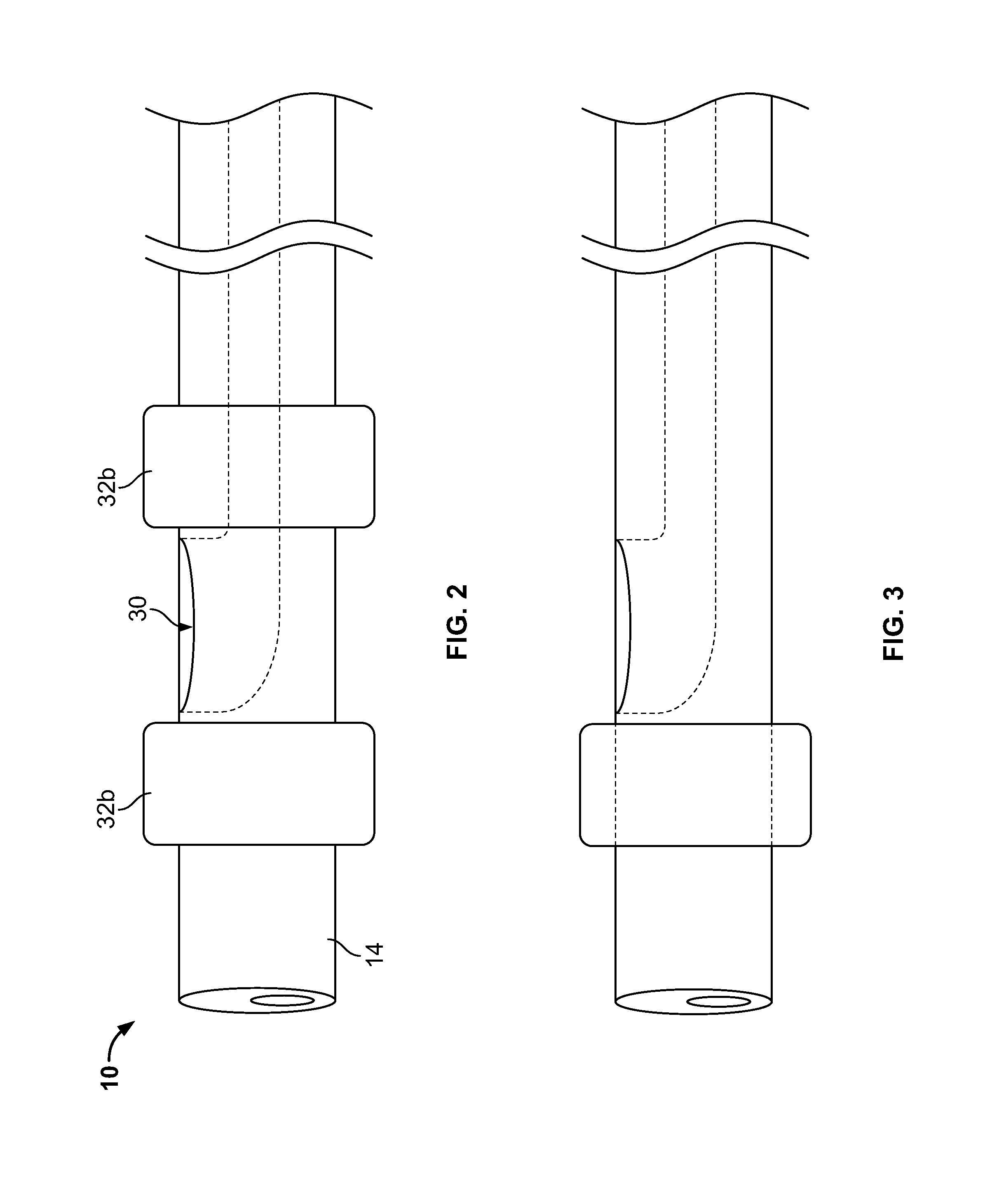 Embolic coil delivery system and method of using same