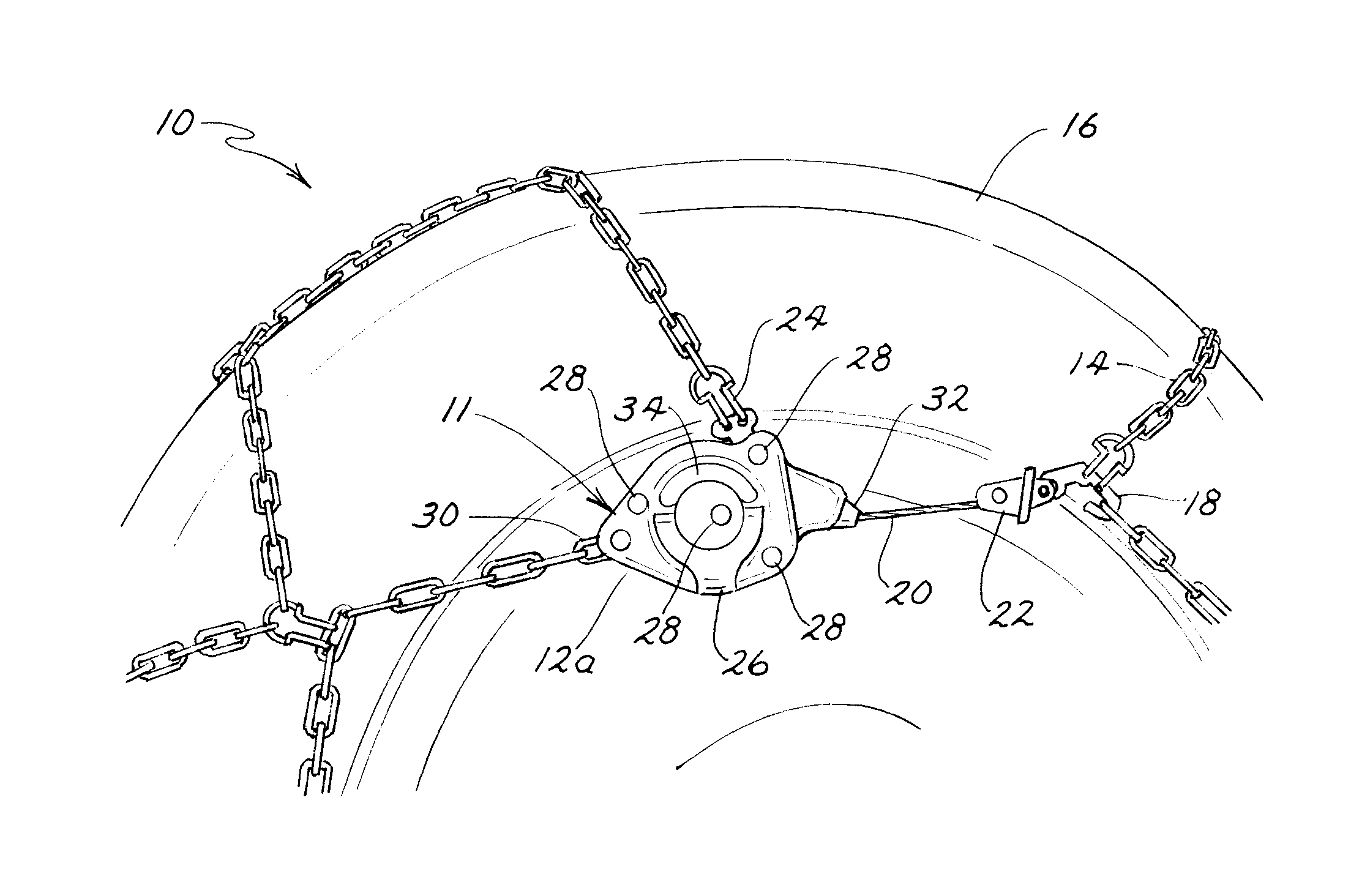 Self-Tightening Traction Assembly Having Tensioning Device