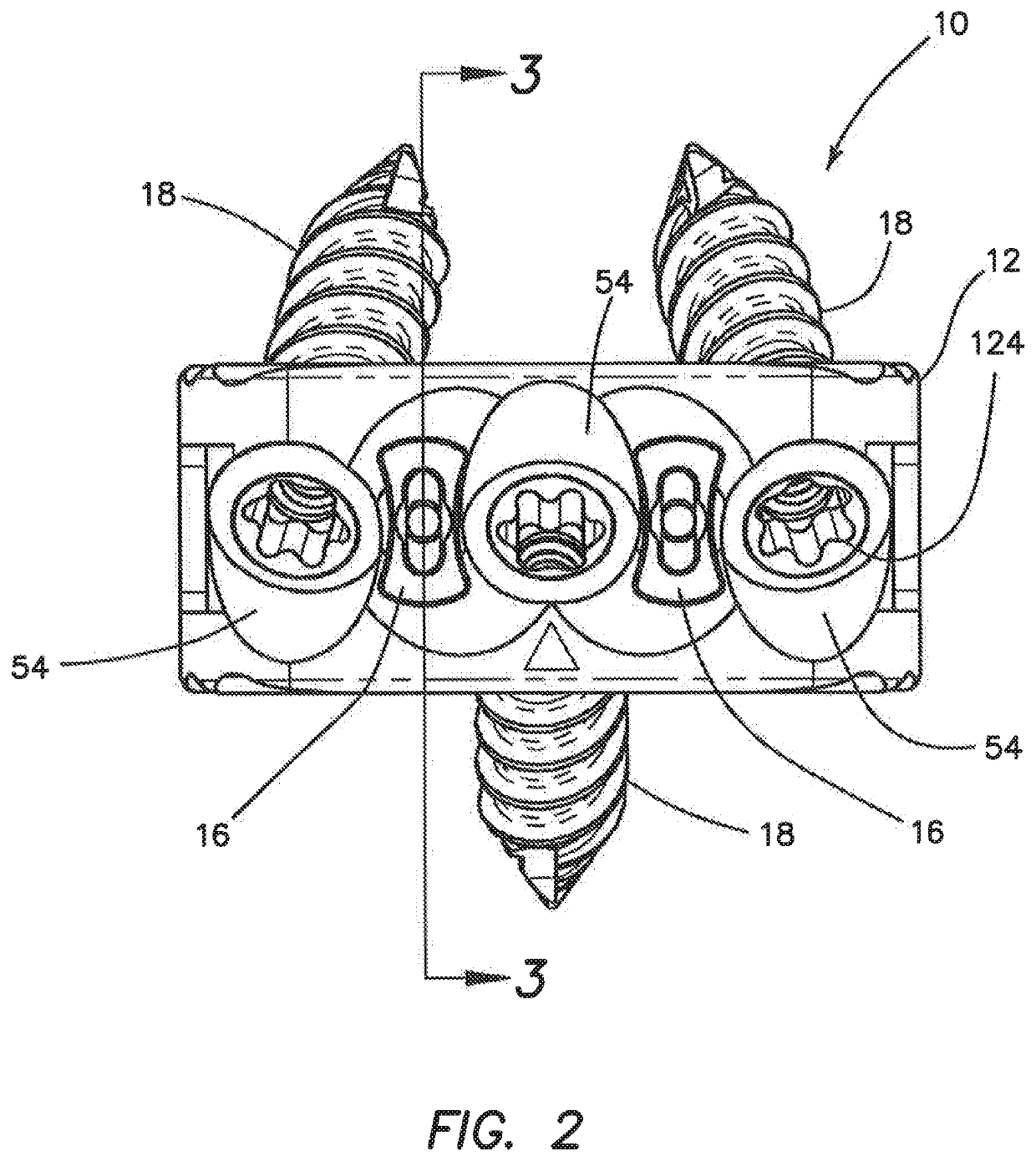 Interbody spacer