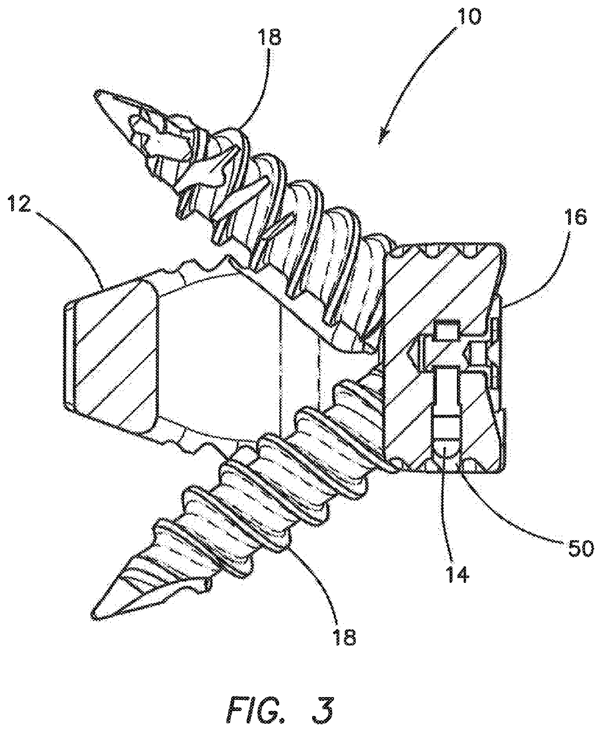 Interbody spacer