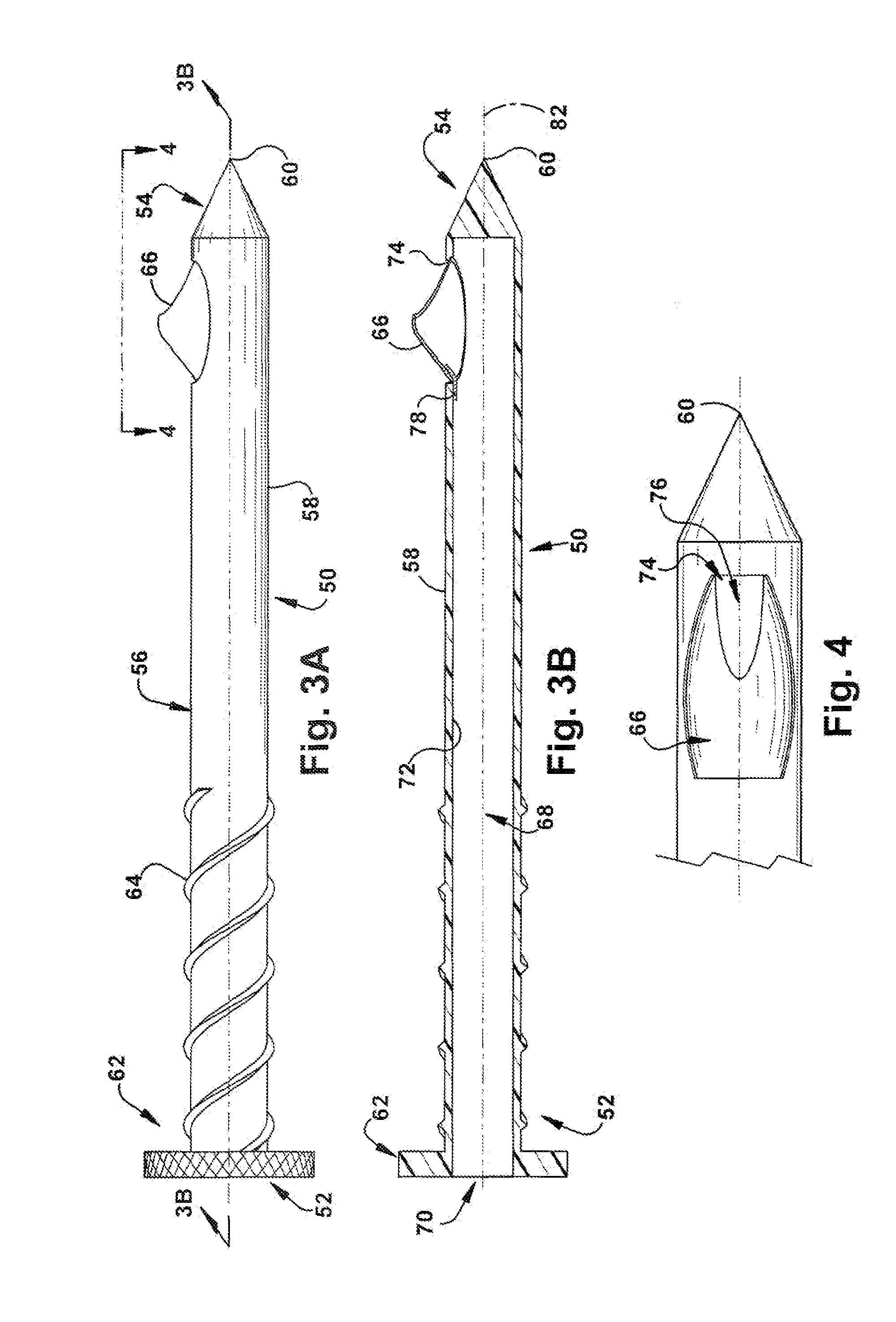 Method and apparatus for tissue sampling