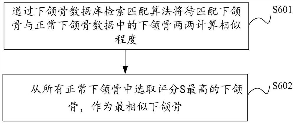 Mandible defect reconstruction method and device, electronic equipment and storage medium