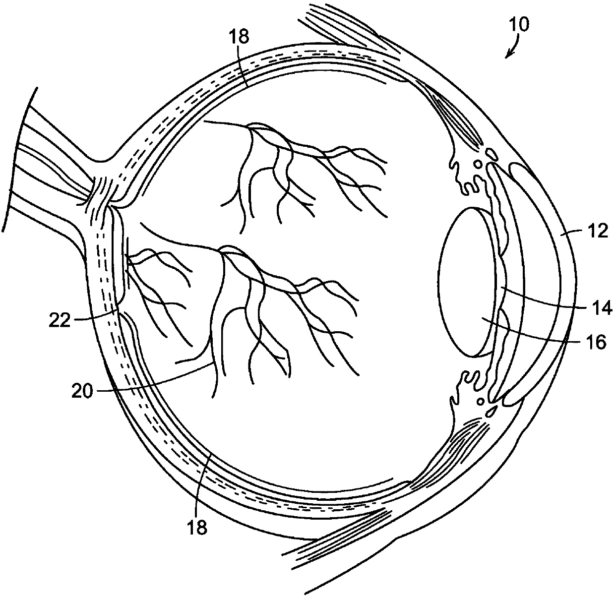 System and process for retina phototherapy