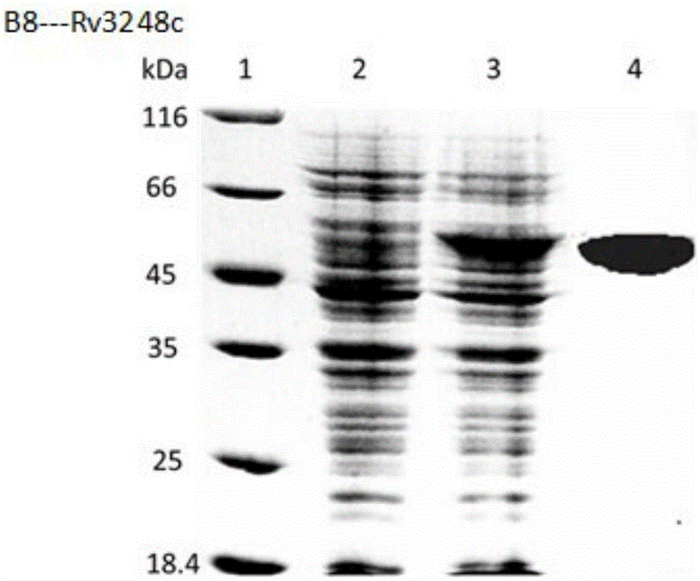 Mycobacterium tuberculosis Rv 3248 c recombinant protein, preparation method and application of mycobacterium tuberculosis Rv 3248 c recombinant protein