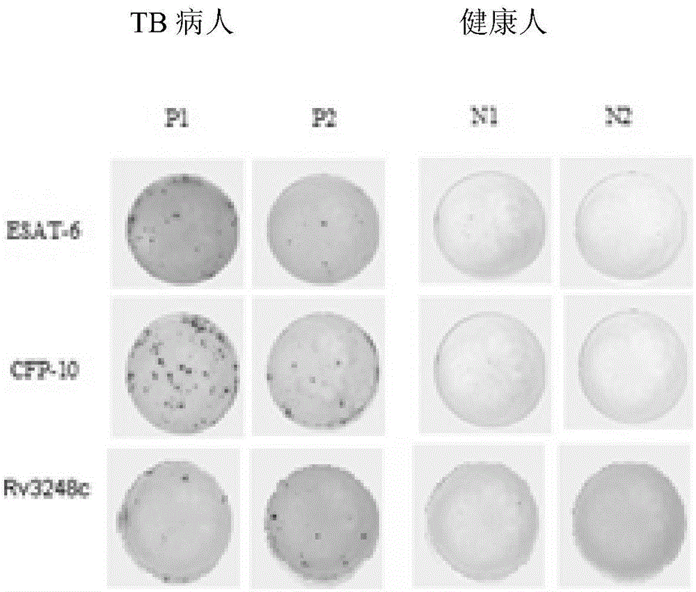 Mycobacterium tuberculosis Rv 3248 c recombinant protein, preparation method and application of mycobacterium tuberculosis Rv 3248 c recombinant protein