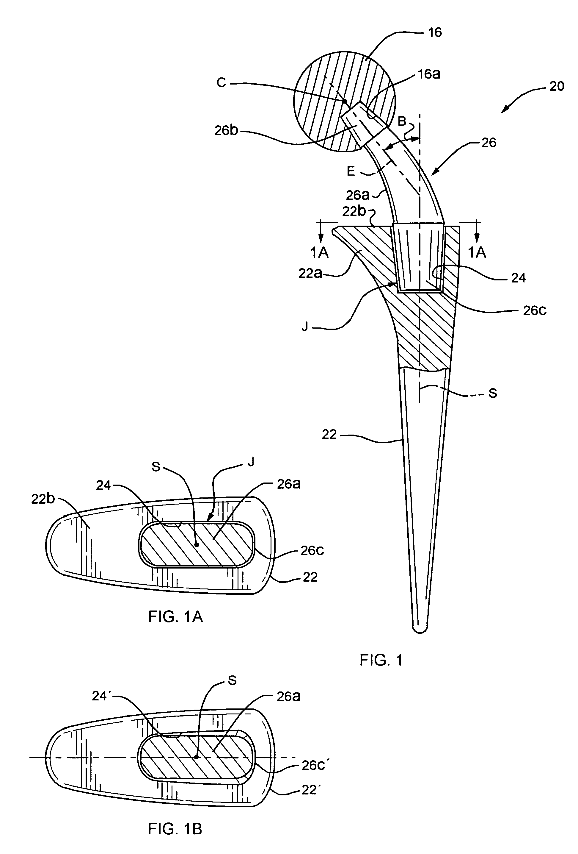 Modular femoral prosthesis with on-axis junction