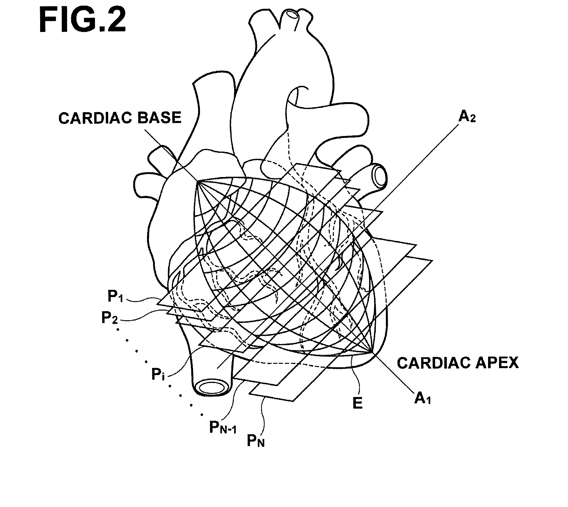Cardiac function display apparatus and program therefor