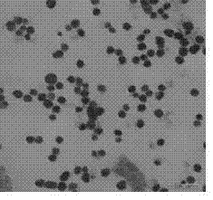 Synthesis method of small core gold-coated ferric oxide core-shell structure nanoparticles