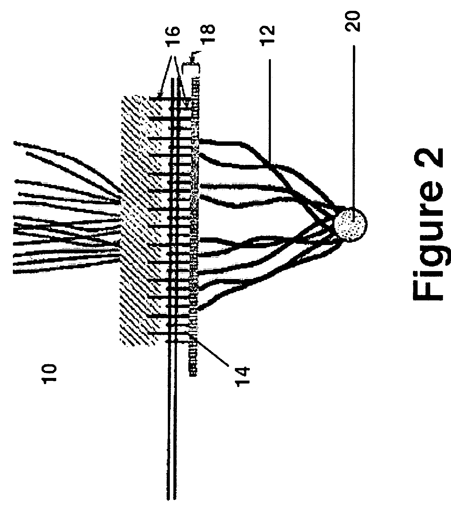Methods and compositions for optimizing the outcomes of refractive laser surgery of the cornea