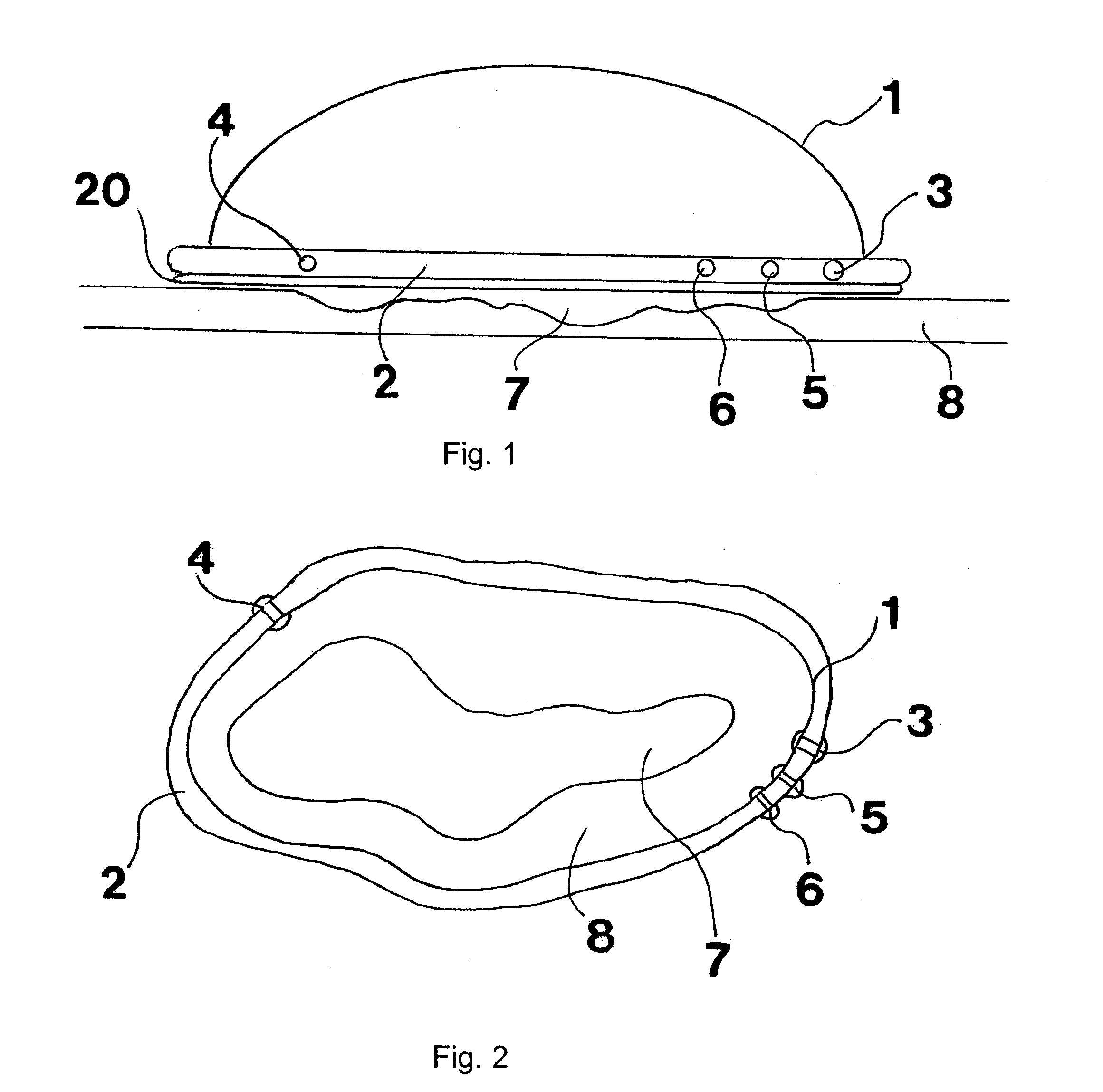 Method and apparatus for the deactivation of bacterial and fungal toxins in wounds, and for the disruption of wound biofilms