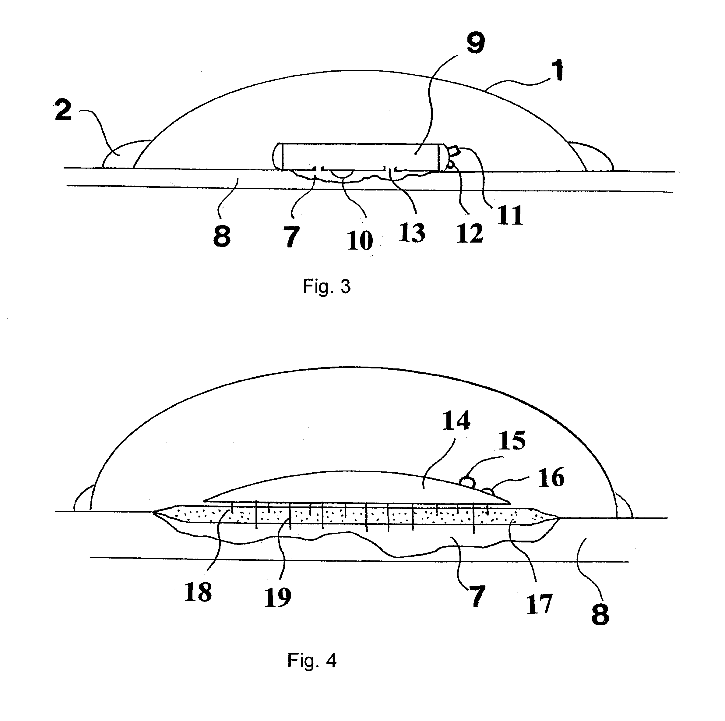 Method and apparatus for the deactivation of bacterial and fungal toxins in wounds, and for the disruption of wound biofilms