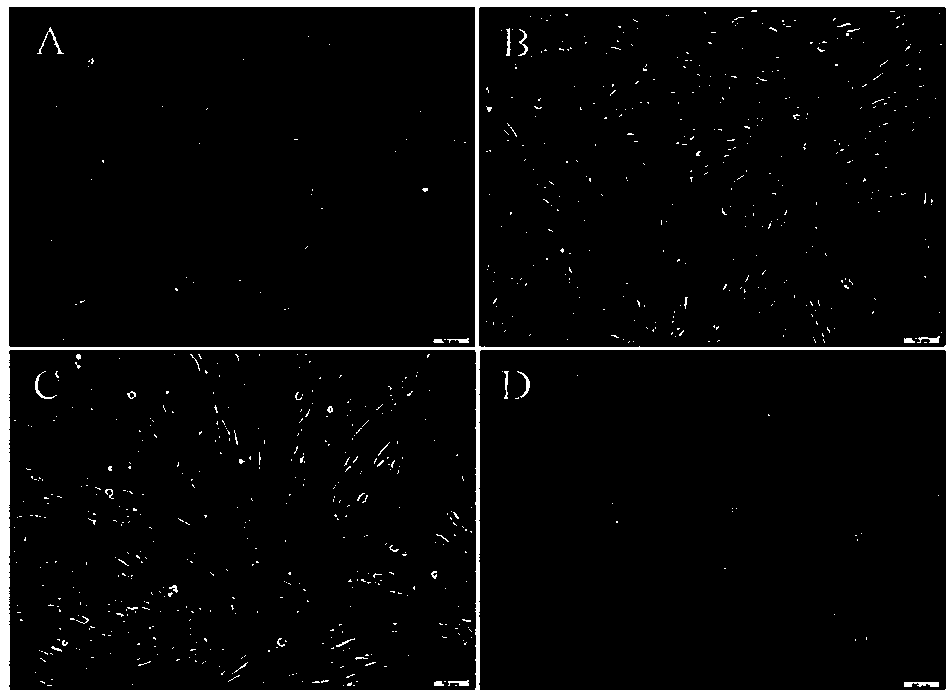 A method for preparing feeder layer cells by suspension-adherence method